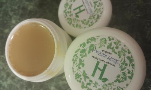 szem alatti karikára